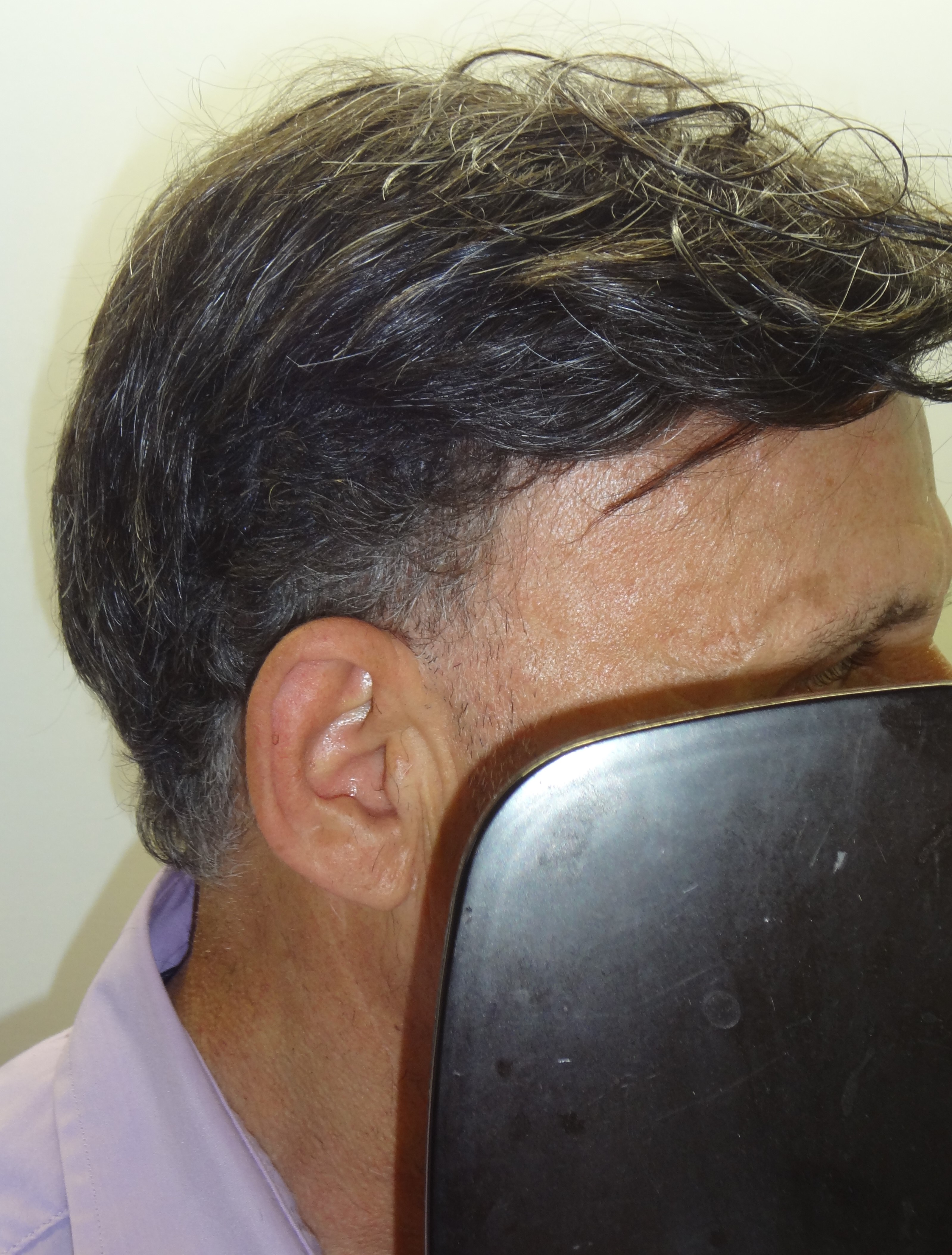 Servei d'estilisme especial per protesis capilars exemple 1
