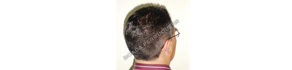 Consells:  La caiguda del cabell Perruqueria per a homes Boada perruquers
